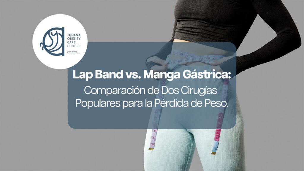 Lap Band vs. Manga Gástrica